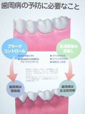 歯周病4.jpg